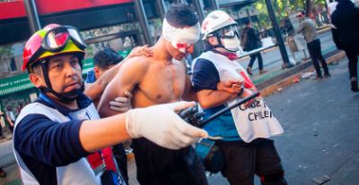 Imagen de una víctima de trauma ocular durante la revuelta social atendidos por rescatistas voluntarios. Foto: Alejandra Fuenzalida.