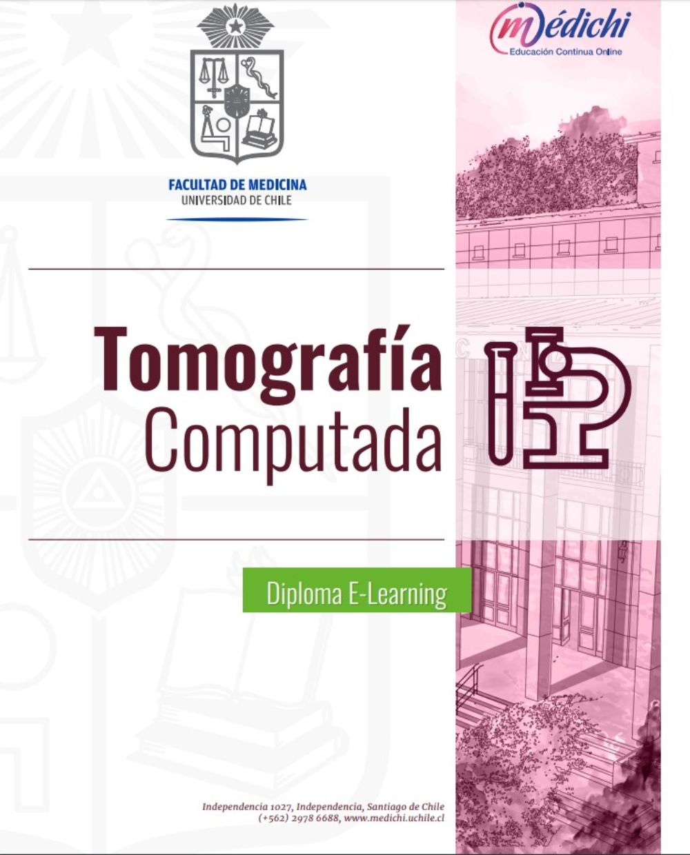 Tomografía computada