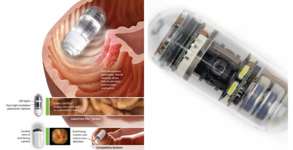 CapsoCam Plus es una cápsula endoscópica de 31 milímetros de largo y 11 milímetros de diámetro, totalmente inalámbrica y que puede ser ingerida por vía oral “de forma muy cómoda para el paciente”, dice la doctora Lucero