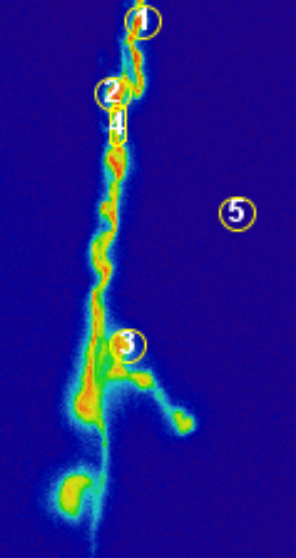 Rama en la unión neuromuscular, marcada con una proteína sensible a calcio expresada en la motoneurona. En círculos se marcan botones que se pueden seguir en el tiempo.