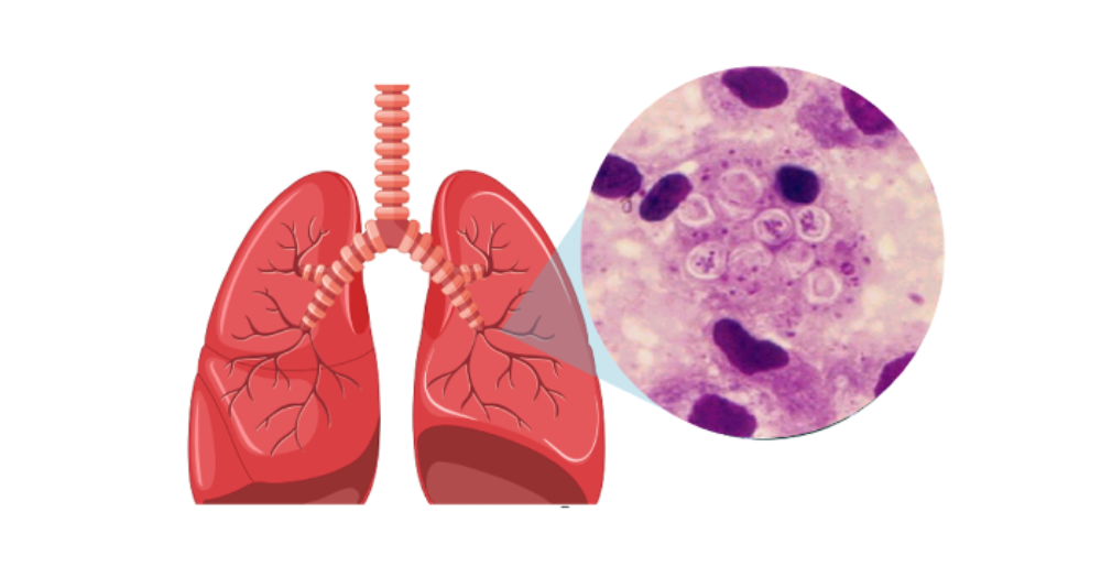 Por primera vez caracterizan microbiota de pulmón en lactantes aparentemente sanos