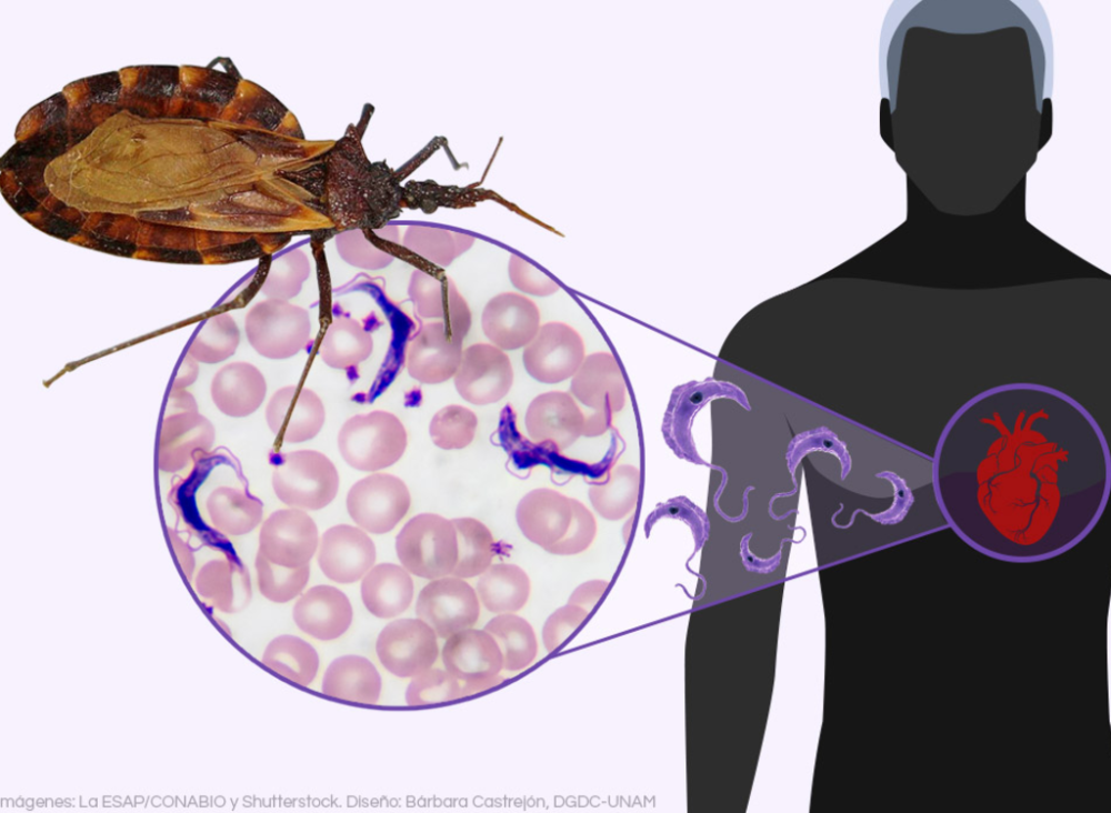 Identifican tres biomarcadores sanguíneos que podrían predecir el daño cardíaco en la enfermedad de Chagas