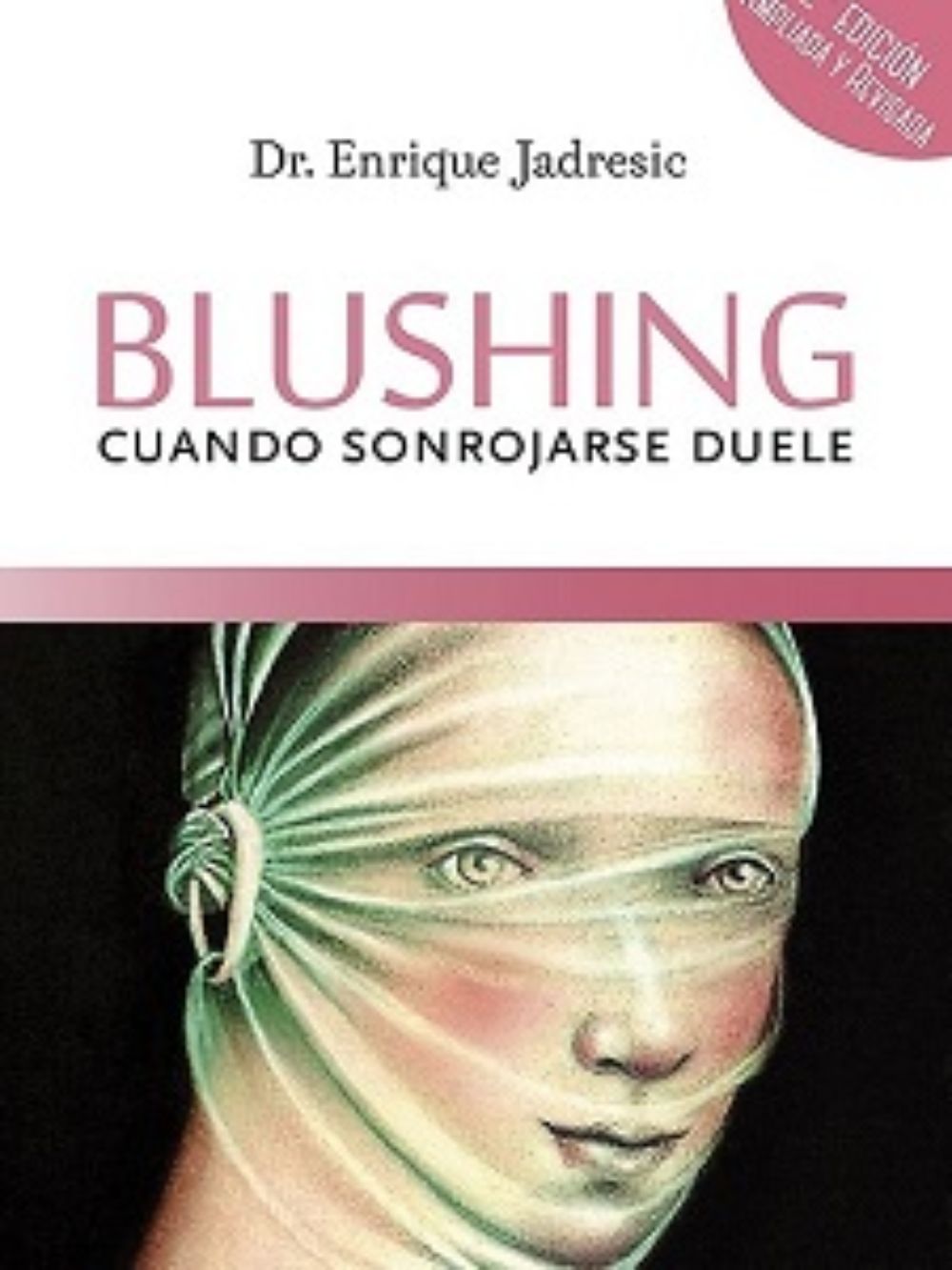 Blushing, cuando sonrojarse duele