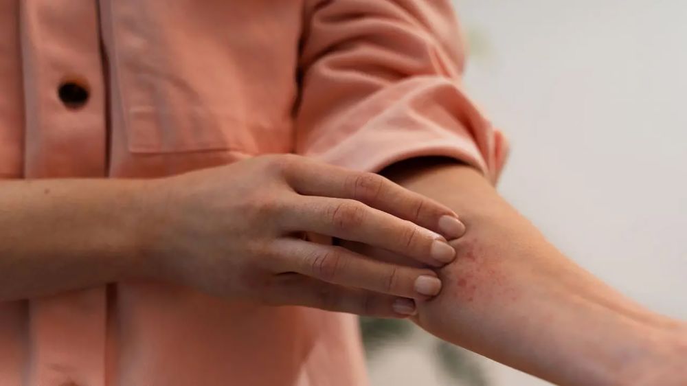 La dermatitis atópica es una patología inflamatoria de la piel es más que solo “piel seca” o “rojiza”. Es una condición que afecta la calidad de vida y necesita cuidados diarios especiales.