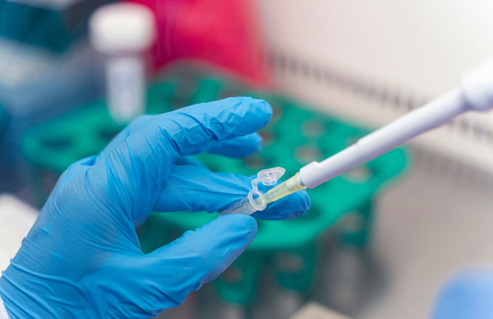 La Facultad de Medicina de la Universidad de Chile, en coordinación de la Vicerrectoría de Investigación y Desarrollo (VID), logró un acuerdo de licenciamiento con la Organización Mundial de la Salud (OMS) y la entidad Medicines Patent Pool (MPP) para una iniciativa que permitirá que países de bajos y medianos ingresos de Latinoamérica puedan acceder gratuitamente a un método de diagnóstico de COVID-19.