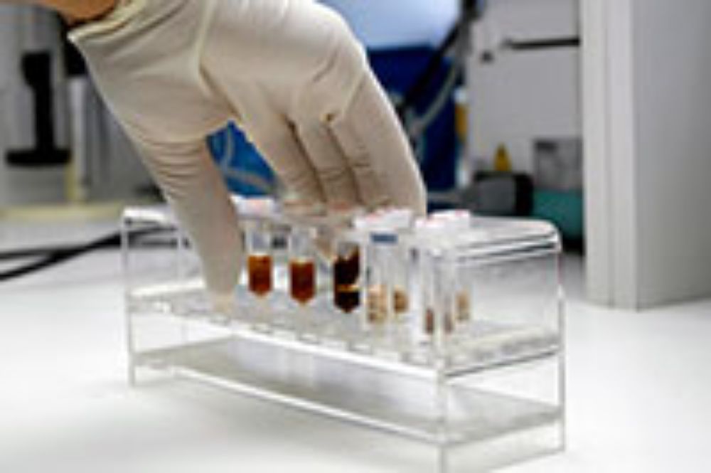 INTA, Nutrición, Alimentos, investigación, doctorado, internacional