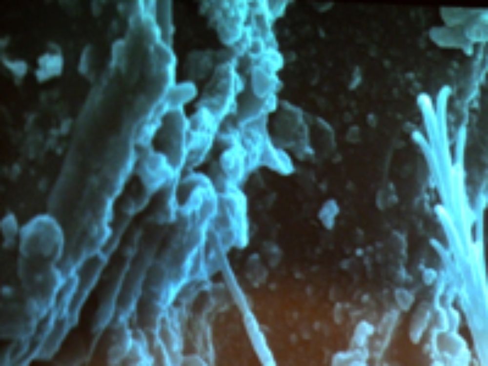 Imágenes que permite captar el nuevo microscopio del Depto. de Antropología