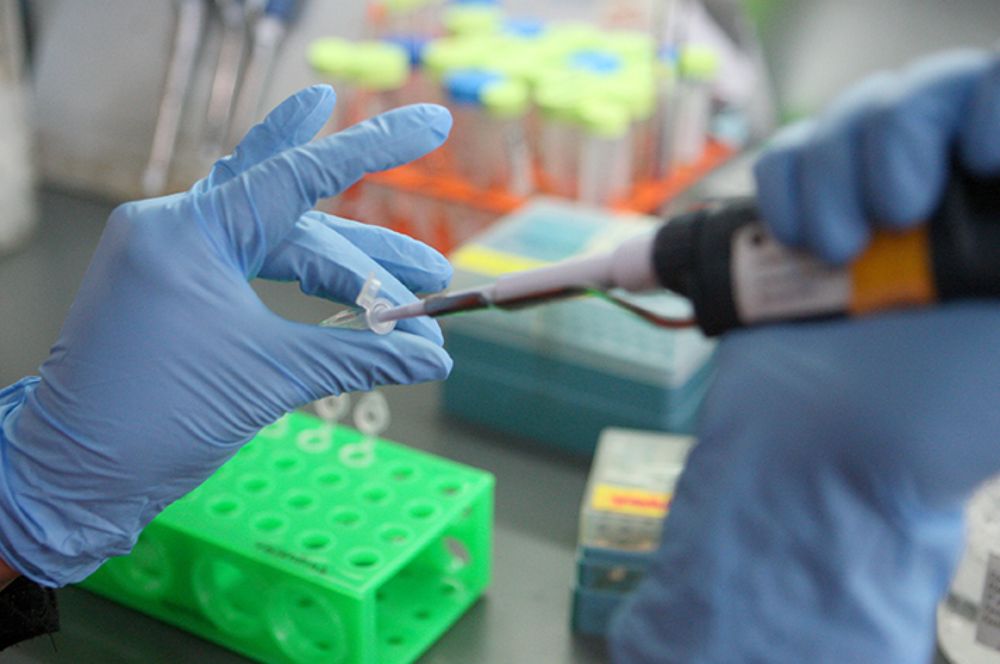 El objetivo del estudio fue develar el rol de las señales de estrés celular, IRE-1, en la patogénesis de esta enfermedad. 