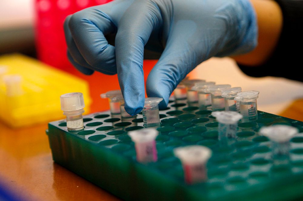 La solicitud de patente busca proteger el concepto de bloquear el sensor de estrés como blanco terapéutico para mejorar el Alzheimer. 