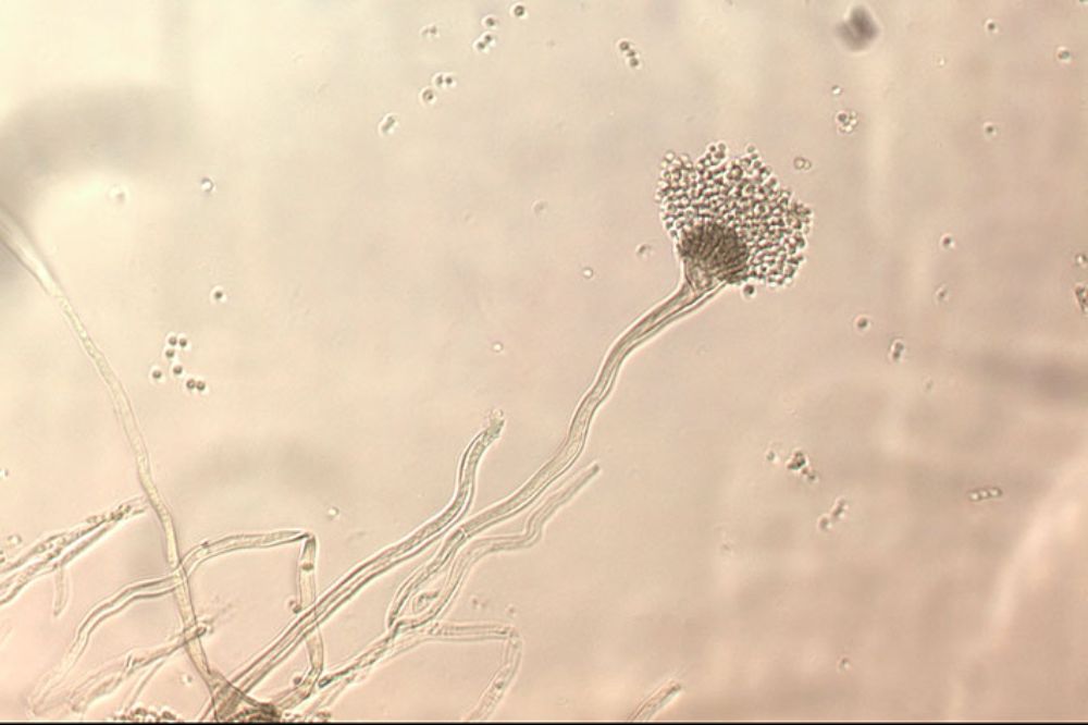 Los chilenos que presentarían infecciones fúngicas graves, alcanzarían los 325 mil anualmente, equivalente a un 2 por ciento de la población.