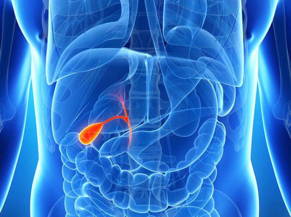 Chile es el país con mayor índice de cáncer a la vesícula en el mundo, patología que afecta principalmente a las mujeres.