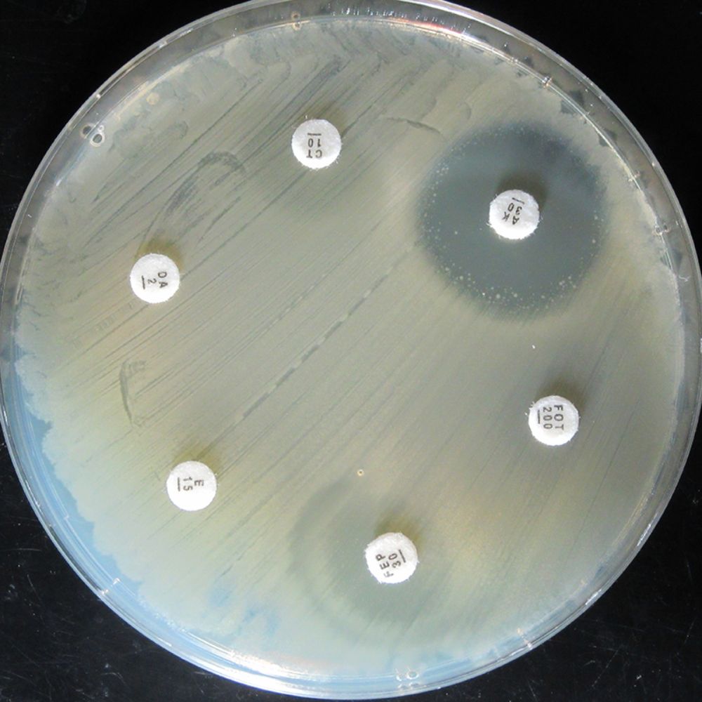 Sin embargo, cada vez más de estos organismos han desarrollado la capacidad de resistir a uno o varios antibióticos, dificultando la capacidad de tratamiento de las enfermedades que producen.