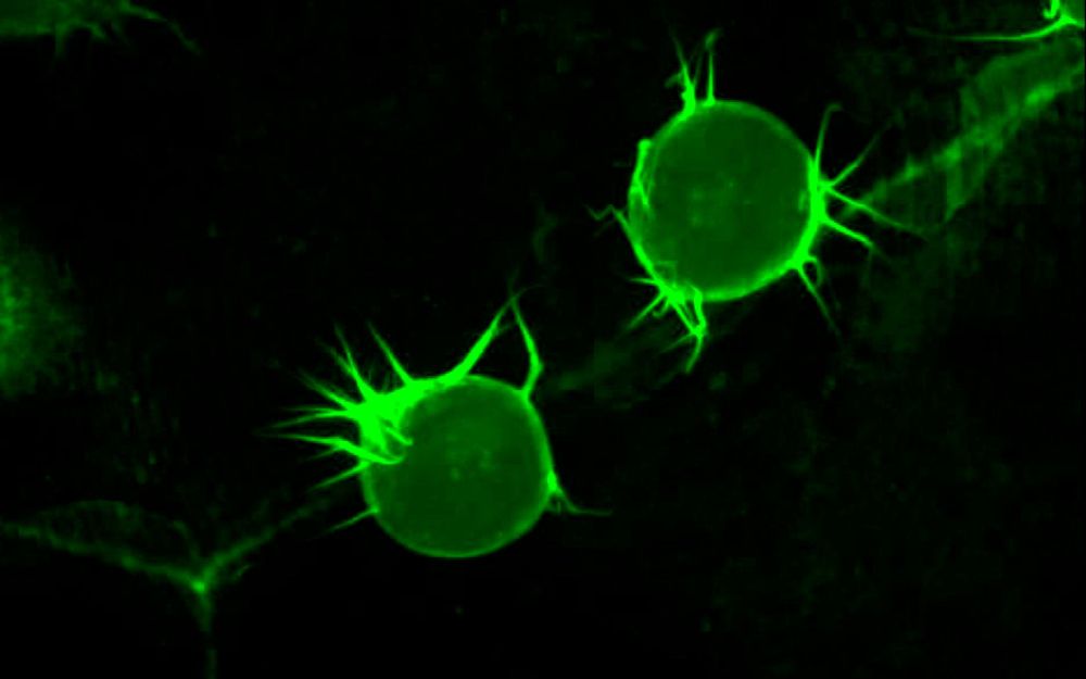 El Núcleo Milenio Física de la Materia Activa se encuentra estudiando las fuerzas mecánicas que influyen en el movimiento celular.