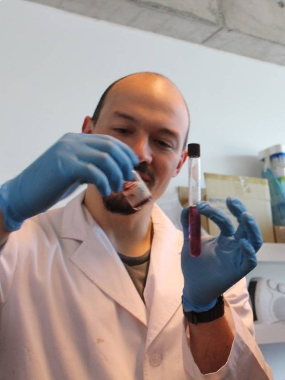 El equipo continua desarrollando nanomateriales que permitan un diagnóstico temprano de la enfermedad.