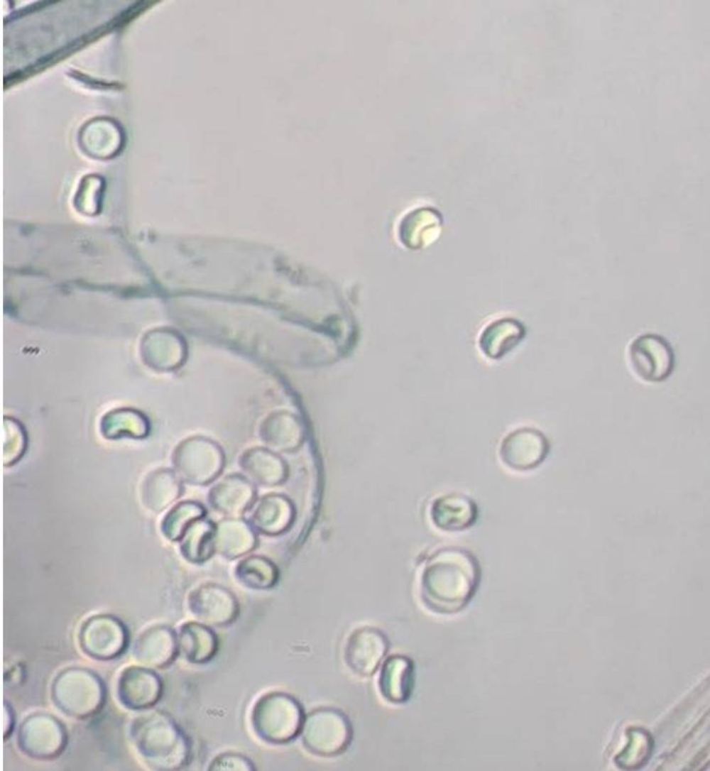 El equipo de investigadores actualmente trabaja en tres muestras de hongos potencialmente no descritos por la comunidad científica: dos de la precordillera de la zona central y otro de Aysén.
