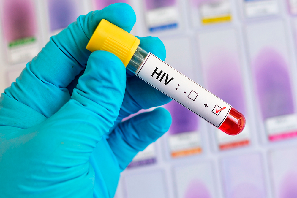 Buscando poner fin a las desigualdades, al SIDA y las pandemias, durante este 1 de diciembre de 2021, la Organización Mundial de la Salud (OMS) y ONU SIDA conmemoran un nuevo Día Mundial del SIDA.