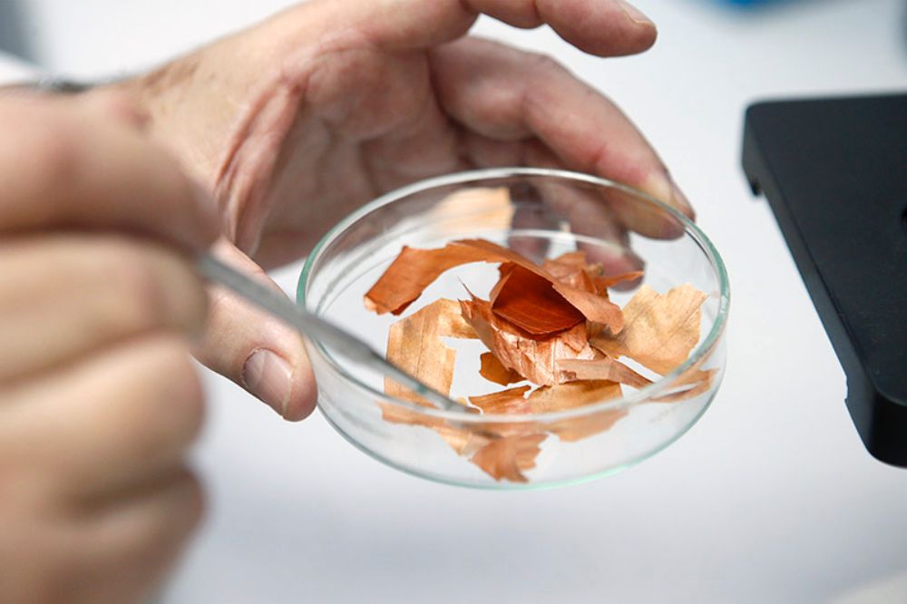 El estudio pionero muestra que la BZF en la piel de cebolla se comporta en las células como el más potente antioxidante y anti-inflamatorio hasta ahora conocido.