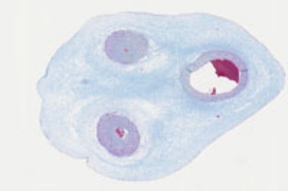 Ejemplo de tejido visualizado a través de microscopía virtual