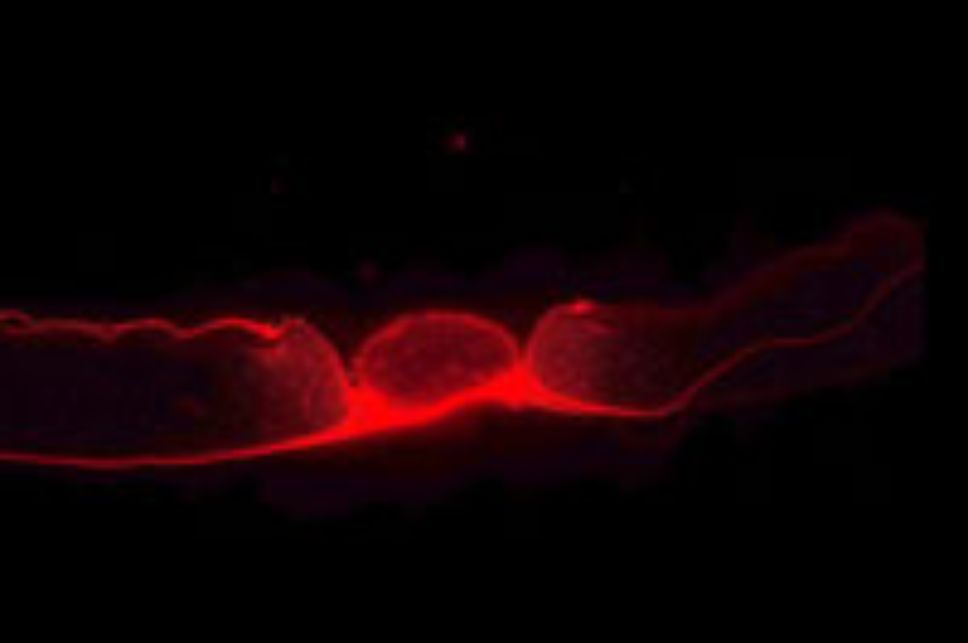 Ejemplo de tejido visualizado a través de microscopía virtual
