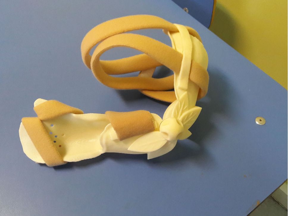 Órtesis impresa en 3D
