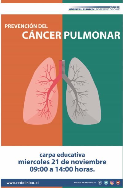 Cáncer pulmonar