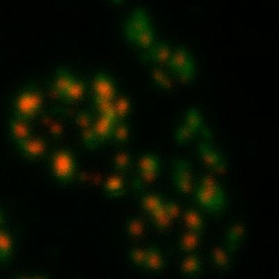 Botón sináptico de la unión neuromuscular de la larva de Drosophila con zonas activas de la región presináptica marcadas en rojo