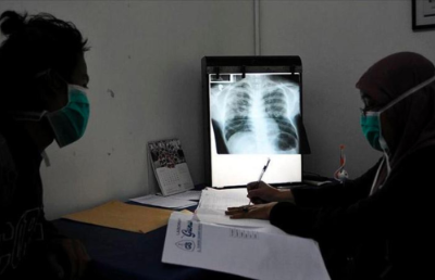 Desde la Facultad de Medicina, uno de los proyectos que se llevarán a cabo es “Tiempo al diagnóstico de tuberculosis en migrantes internacionales desde su llegada a Chile. Factores asociados y evolución del tratamiento: estudio longitudinal”.