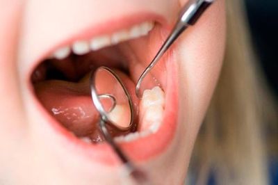 Casi el 50 por ciento de los niños las presenta caries.