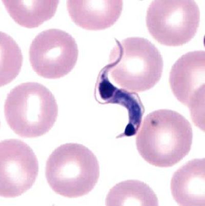 El parásito Trypanosoma cruzi es el protozoo que causa la enfermedad de Chagas.