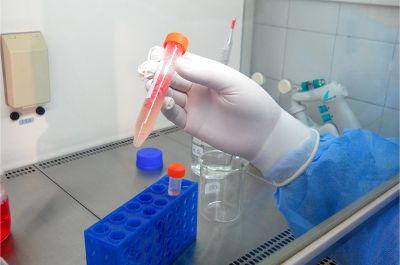 El Laboratorio de Biomedicina y Medicina Regenerativa (BiMre) del Departamento de Ciencias Clínicas de FAVET, desarrolló el proyecto FONDECYT de iniciación N° 11130257.