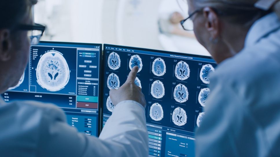 Recientemente se lanzó un examen de sangre que podría predecir la demencia tipo Alzheimer con al menos 10 años de anticipación, pero especialistas sostienen que se debe tomar con cautela.