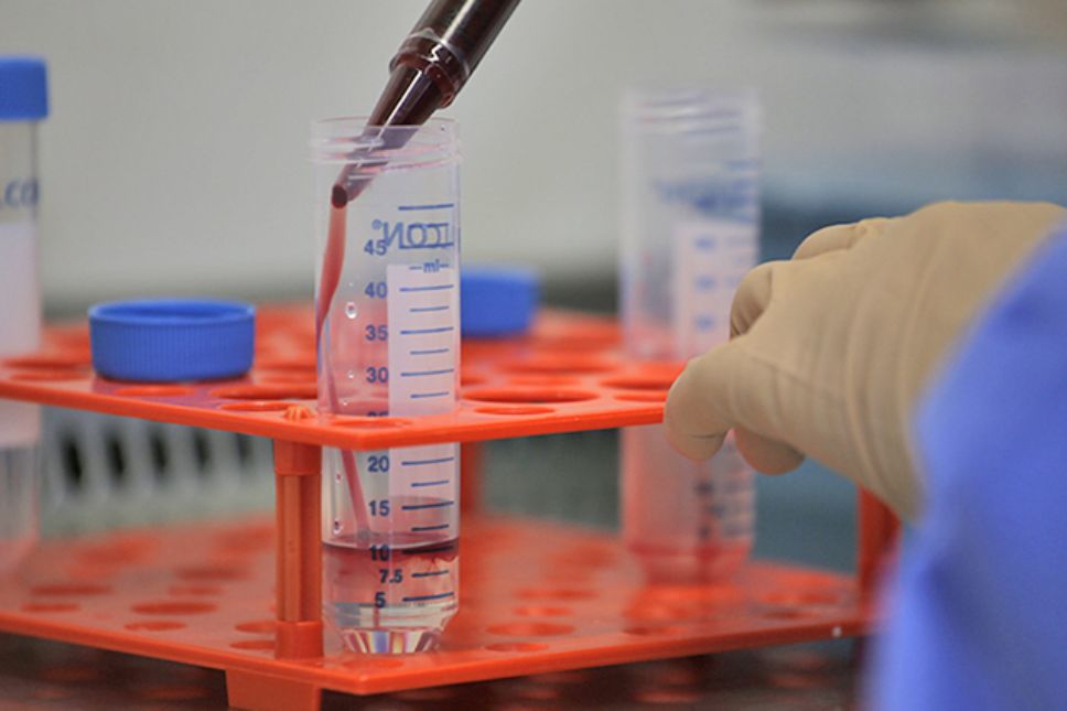 Actualmente es clave seguir investigando si los biomarcadores podrían predecir el riesgo de desarrollar una demencia antes de proponerlos como examen diagnóstico a la población general.